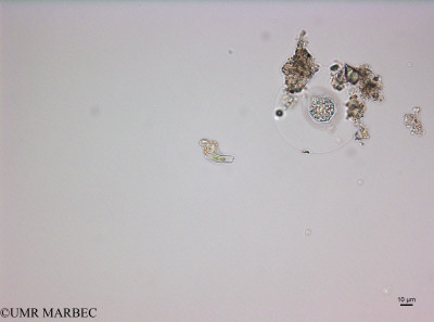 phyto/Thau_Lagoon/THAU_station1/OSU_plancton 2017/Achnanthes sp (100117_achnantes180518_001_ovl-1).tif(copy)_thumb.jpg